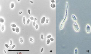 Brettanomyces/Dekkera: control y detección en bodegas