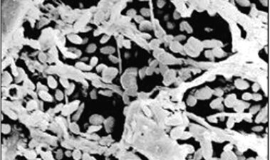 Métodos preventivos y curativos para evitar el desarrollo de la levadura contaminante Brettanomyces bruxellensis en el vino